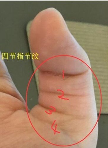数数看,你的大拇指有几节指节纹?